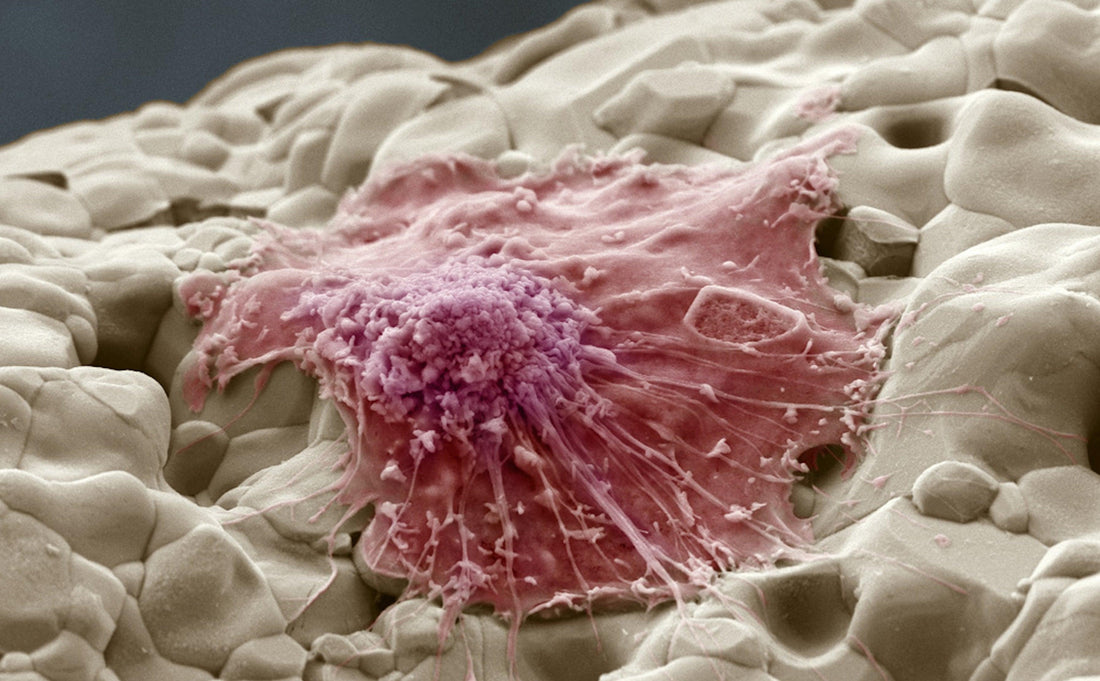 Closeup microscopic image of an osteoclast, the cell responsible for bone resorption in osteoporosis